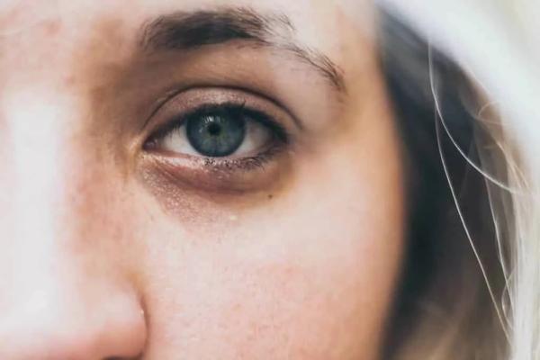 برترین روش ها برای درمان چروک های دور چشم